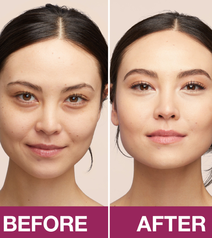 anti aging megoldások a renata által)