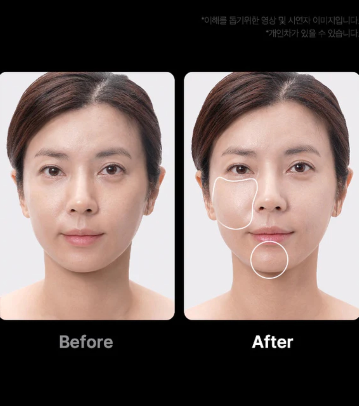 Buy Medicube - *Age-R* - Advanced Facial Care Device Booster