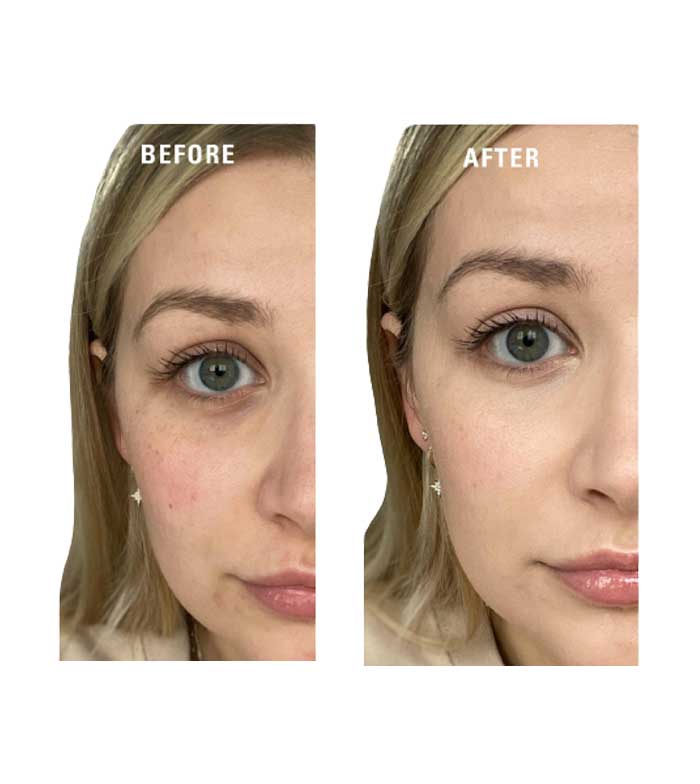 Buy Revolution Cream Color Primer Superbase Colour Correcting