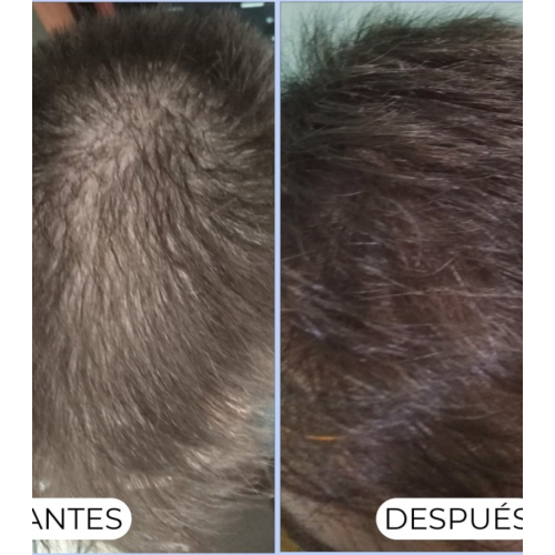 Alma Secret - Purifying shampoo Shikakai for normal or oily hair