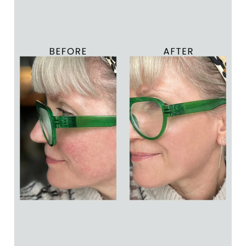 Altruist - Day Cream Dermatologist Anti-Redness & Pigmentation Light SPF50