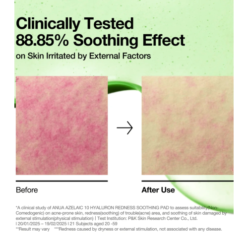 Anua - Pads Azelaic 10 Hyaluron Redness Soothing pads format