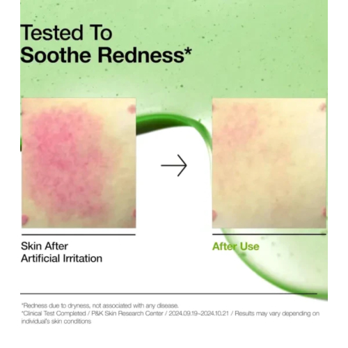 Anua - Anti-acne serum with 10+ azelaic acid and hyaluronic acid