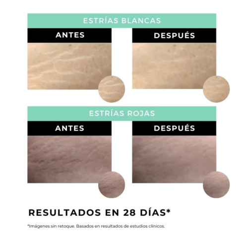 Arganour - Anti-stretch mark body cream