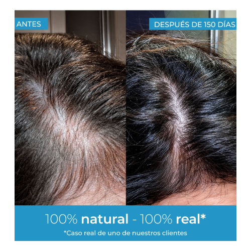 Arganour - Strengthening Hair Serum Strength