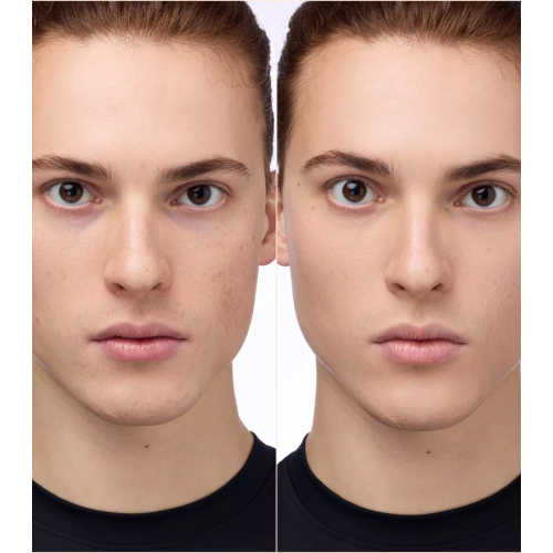 Catrice - Concealer Instant Bright - 032N