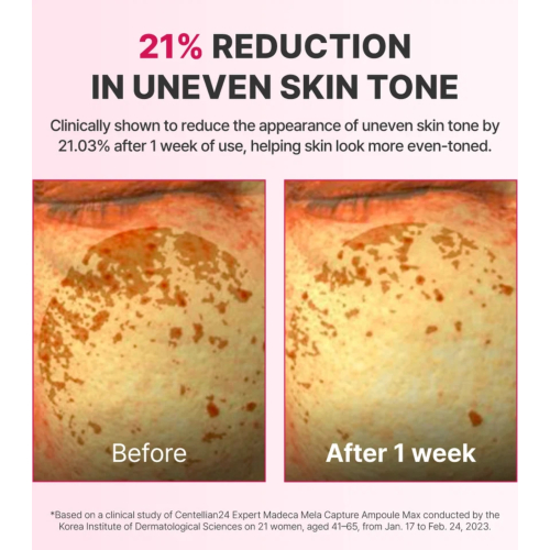 Centellian24 - Anti-spot serum Expert Madeca Mela Capture