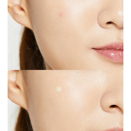 COSRX - Acne Pimple Master Patch
