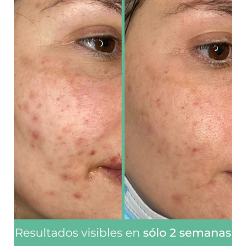 CR Cosmetics - *Purifying* - Sebum-regulating facial cream