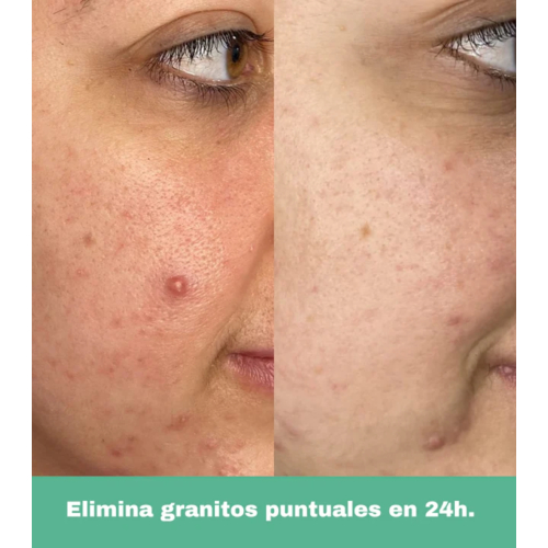 CR Cosmetics - *Purifying* - Roll on anti-blemishes