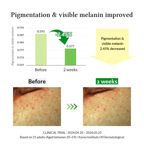 Dr. Althea - Depigmentation Serum Gentle Vitamin C