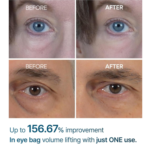 Dr.Melaxin - Dark Circle Cream Eyephalt