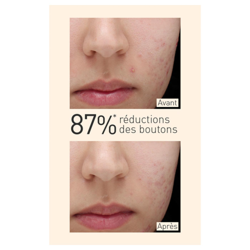 Embryolisse - Mattifying serum for combination to oily skin with Turmeric extract