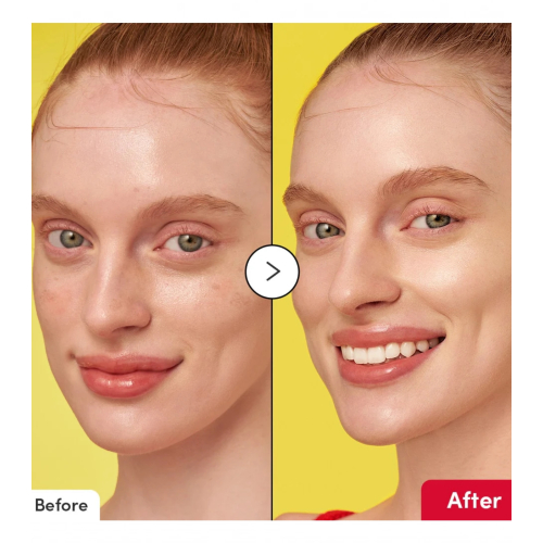 Eqqualberry - Brightening Facial Serum Vitamin