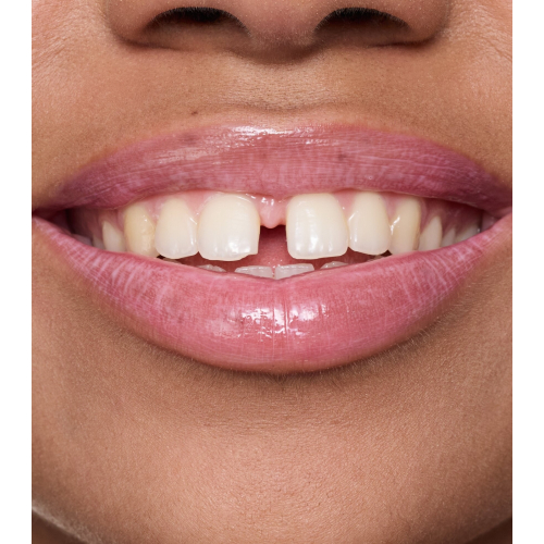 essence - Lip Balm Milky Glazed - 02: Strawberry Whip