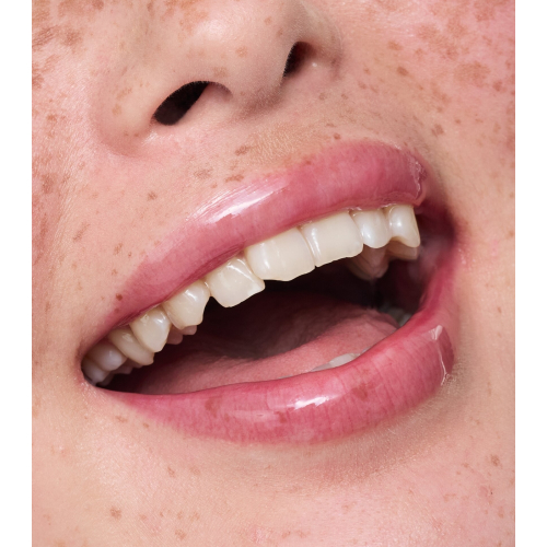 essence - Lip Treatment Juicy Serum - 01: Raspberry