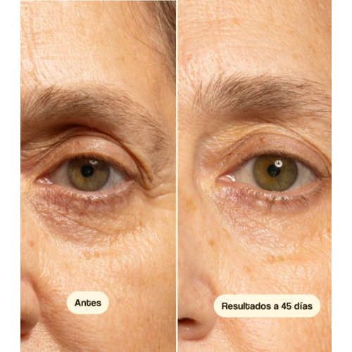 Freshly Cosmetics - Anti-Wrinkle Eye Contour Exosome Well-Ageing