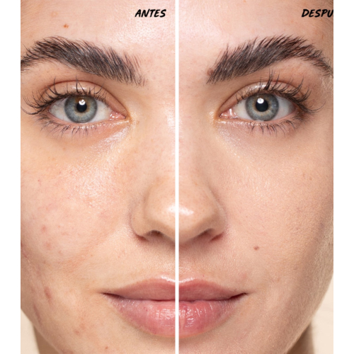 Freshly Cosmetics - Multi-Use Concealer Vitamin Fix - 300 Apricot Nectar