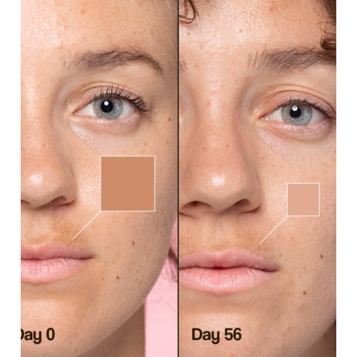 Freshly Cosmetics - Depigmenting facial cream Lotus Radiance Dark Spot Treatment