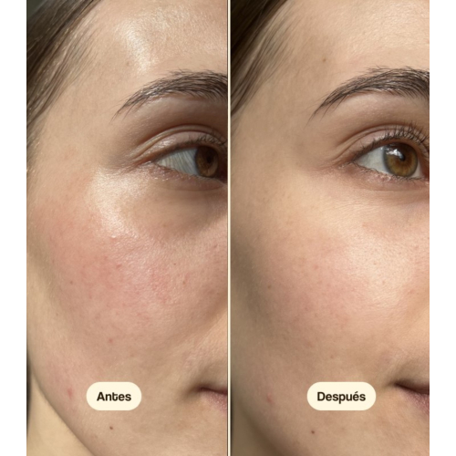 Freshly Cosmetics - Centella Asiatica Moisturizing Day Cream CICA Calm - Dry and sensitive skin