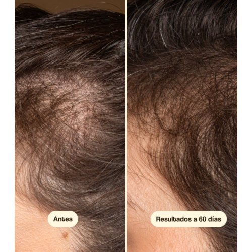 Freshly Cosmetics - Anti-hair loss treatment Hair Growth & Density