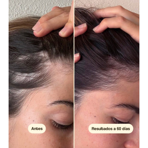 Freshly Cosmetics - Anti-hair loss treatment Hair Growth & Density