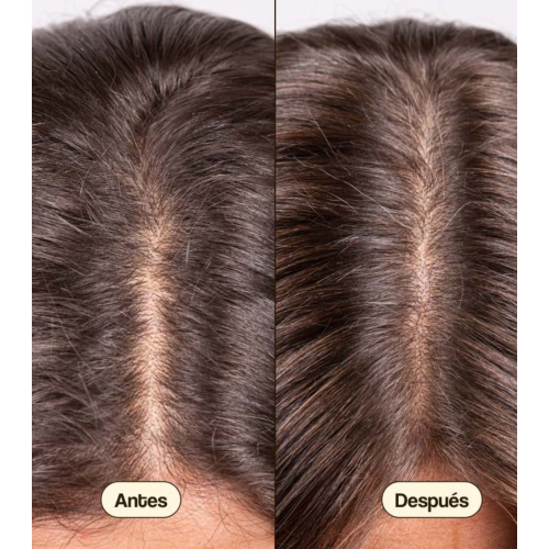 Freshly Cosmetics - Anti-hair loss treatment Hair Growth & Density