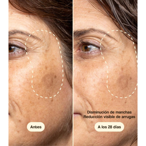 Freshly Cosmetics - Facial Treatment with Vitamin C