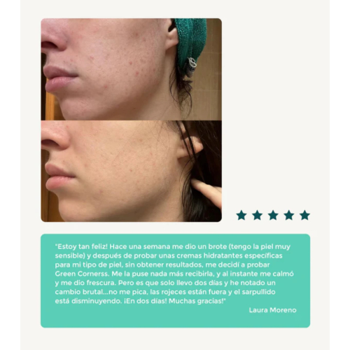 Green Cornerss - Cabbage Moisturizing Facial Cream - Atopic Skin