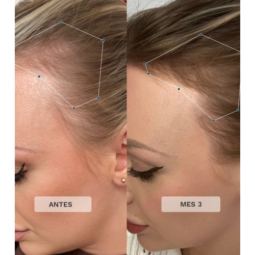 Hairburst - Hair Vitamins Advance + Premium