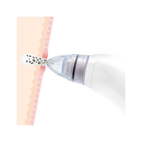 InnovaGoods - Electric facial cleanser for blackheads Pore·Off