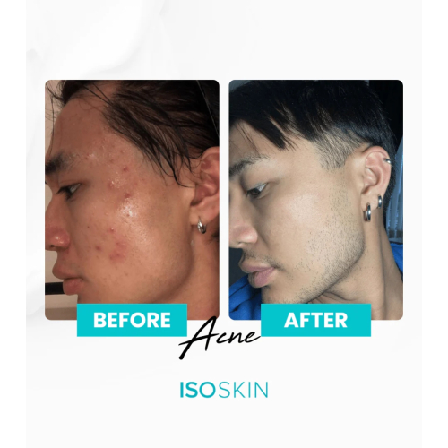 ISOCLEAN - *ISOSKIN* - Face and body spray Hypochlorous - 100ml