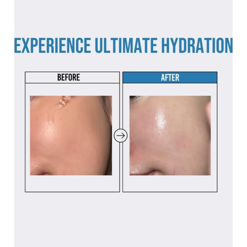 Jumiso - *Waterfull* - Moisturizing facial serum Hyaluronic Acid