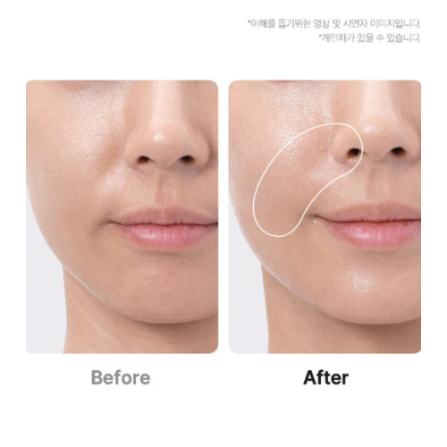 Medicube - *Age-R* - Advanced Facial Care Device Booster Pro Ex