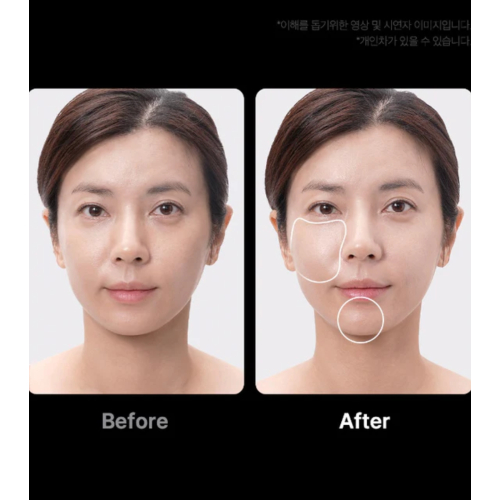 Medicube - *Age-R* - Advanced Facial Care Device Booster Pro Ex