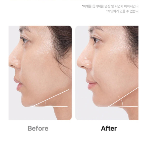 Medicube - *Age-R* - Advanced Facial Care Device Booster Pro Ex - Pink