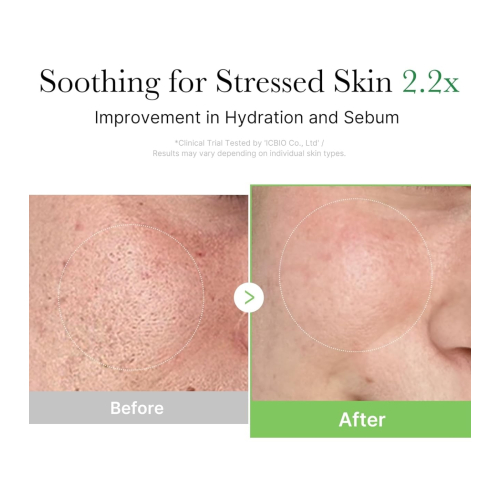 Medicube - *Cica* - Repairing facial cream Exosome Cica Cream