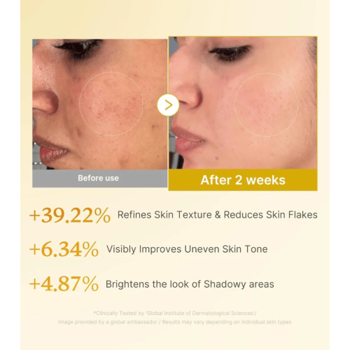 Medicube - *Kojic Acid* - Exfoliating facial toner