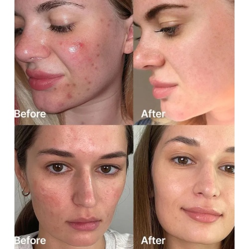 Medicube - *Red* - Serum Red Succinic Acid Clarifying