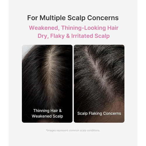 Medicube - Scalp Serum Rosemary PDRN