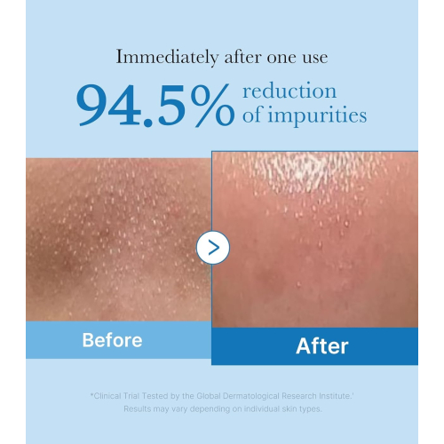 Medicube - *Zero Pore* - Cleansing Oil Blackhead Deep