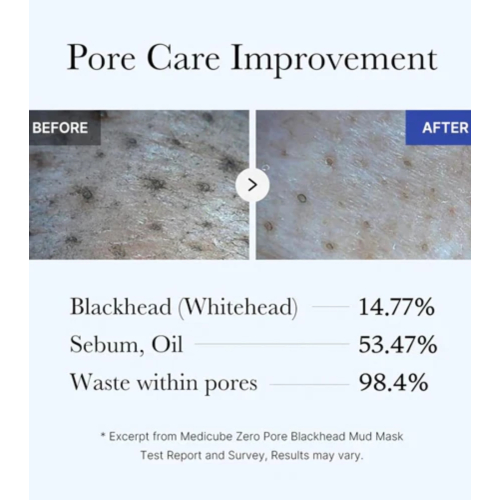 Medicube - *Zero Pore* - Mask with AHA, BHA and PHA Blackhead Mud Mask