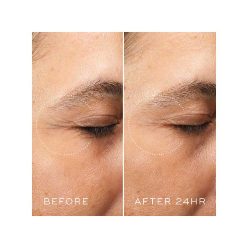 Medik8 - *Crystal Retinal* - Anti-aging eye contour cream with Retinal and Vitamin A Ceramide Eye 6