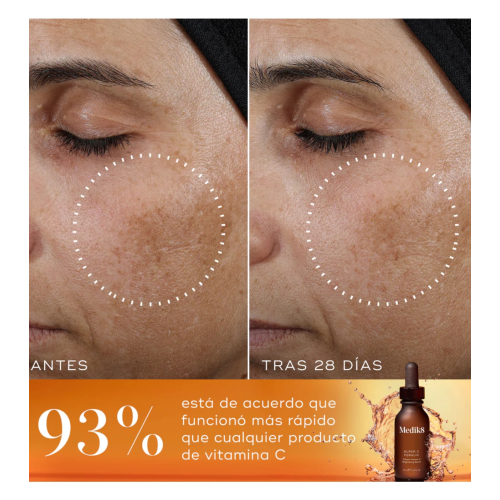 Medik8 - Brightening Serum with Vitamin C Super C Ferulic