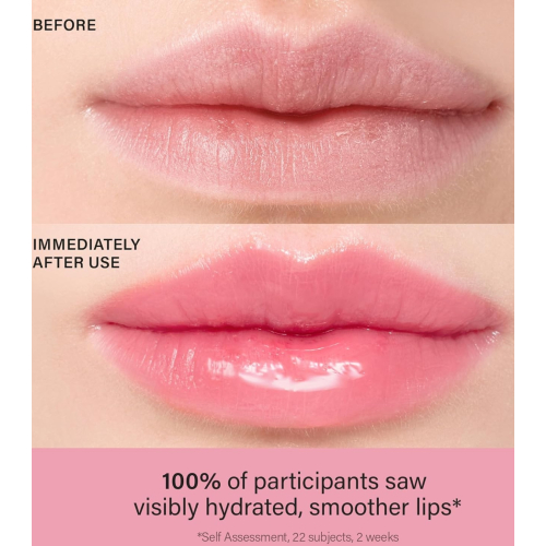 Melixir - Lip Treatment - 02: Rose