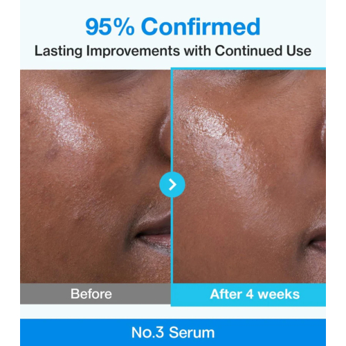 Numbuzin - Pore Minimizing Serum No.3 Blue Bio-Retinol