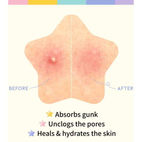 OOTD Beauty - Star Spot Patch Star Spot Patch