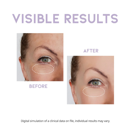 OOTD Beauty - Overnight Eye Serum