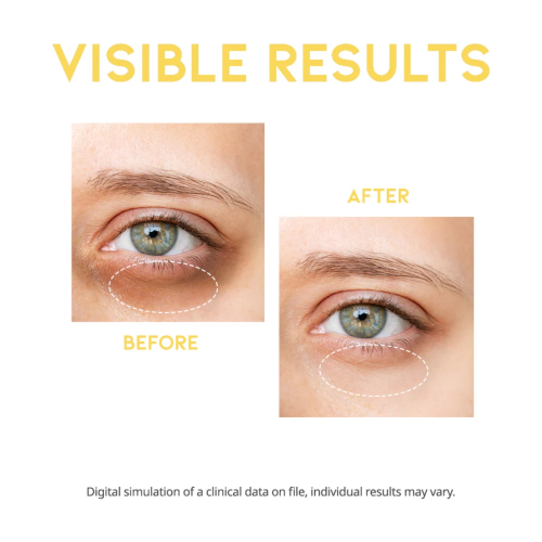 OOTD Beauty - Illuminating Eye Serum Dark Circle