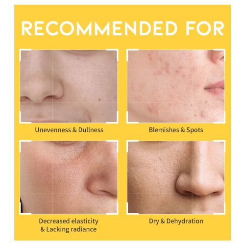 OOTD Beauty - Dark Spot Vitamin C Illuminating Toner